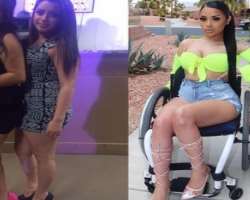 You will definitely be proud of her after knowing the fact that she suffered a serious car accident when she was seventeen. As a result of the acciden